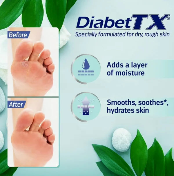Diabet TX Body Moisturizer for Diabetic Skin, 13.5 oz
