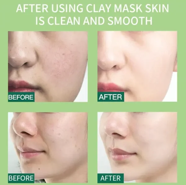 10 Container Clay Facial Set Bundle