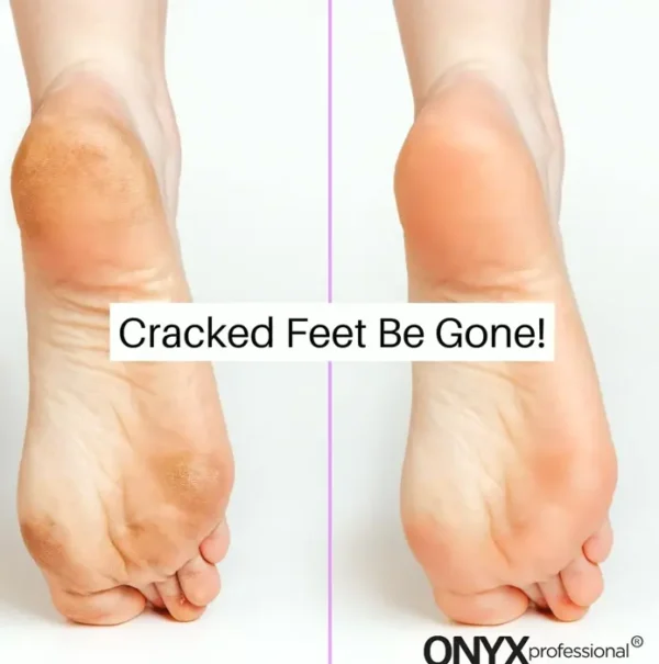 Moisturizing Spa Socks, Dry Feet Treatment