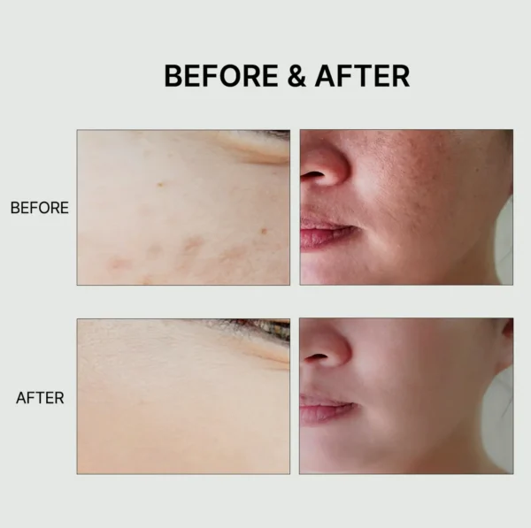 Moisturizing Rice Toner with Centella & Rice Water, 150mL