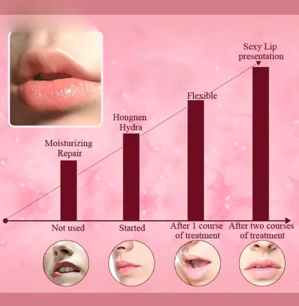Lip Mask 30PCS Pink Gel Pads Treatment