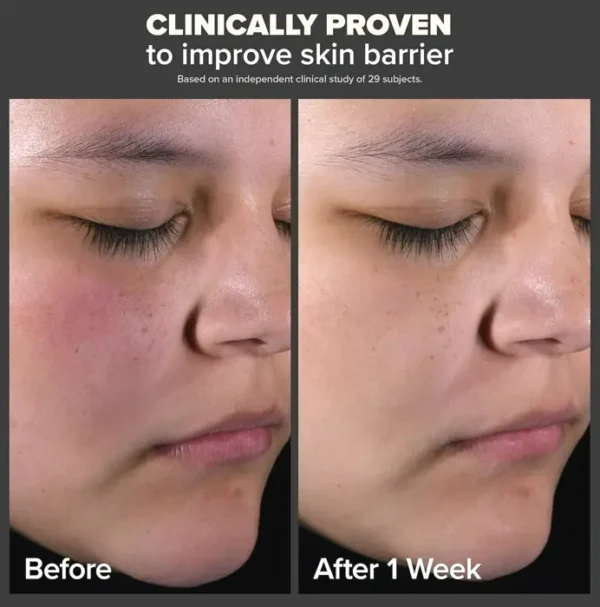 Paula's Choice Two Percent BHA Skin Exfoliator to Treat Wrinkles