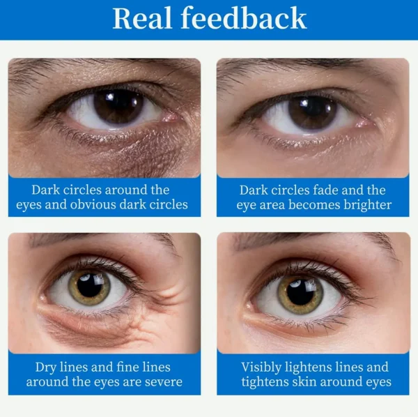 Under Eye Mask (Sixty-four Pcs) – Chilling & Luminous Hyaluronic Acid Eye Care